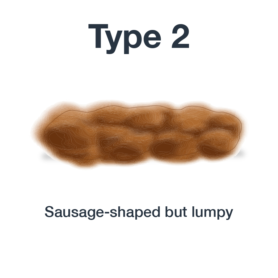 types of stool