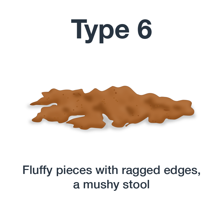 types of stool